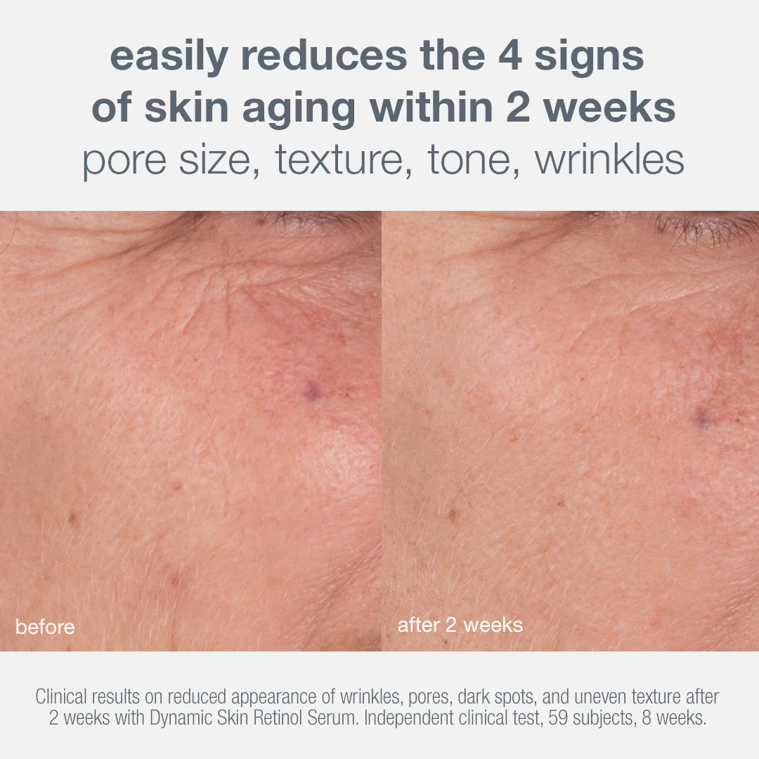 Skin aging solutions